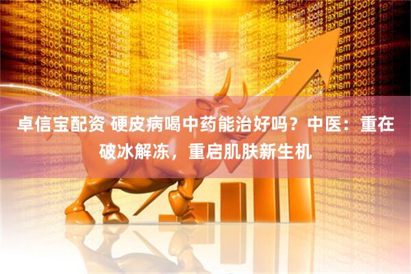 卓信宝配资 硬皮病喝中药能治好吗？中医：重在破冰解冻，重启肌肤新生机